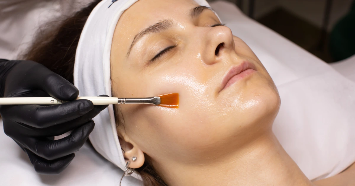 A women receiving Chemical Peels Treatment in Red Bank NJ