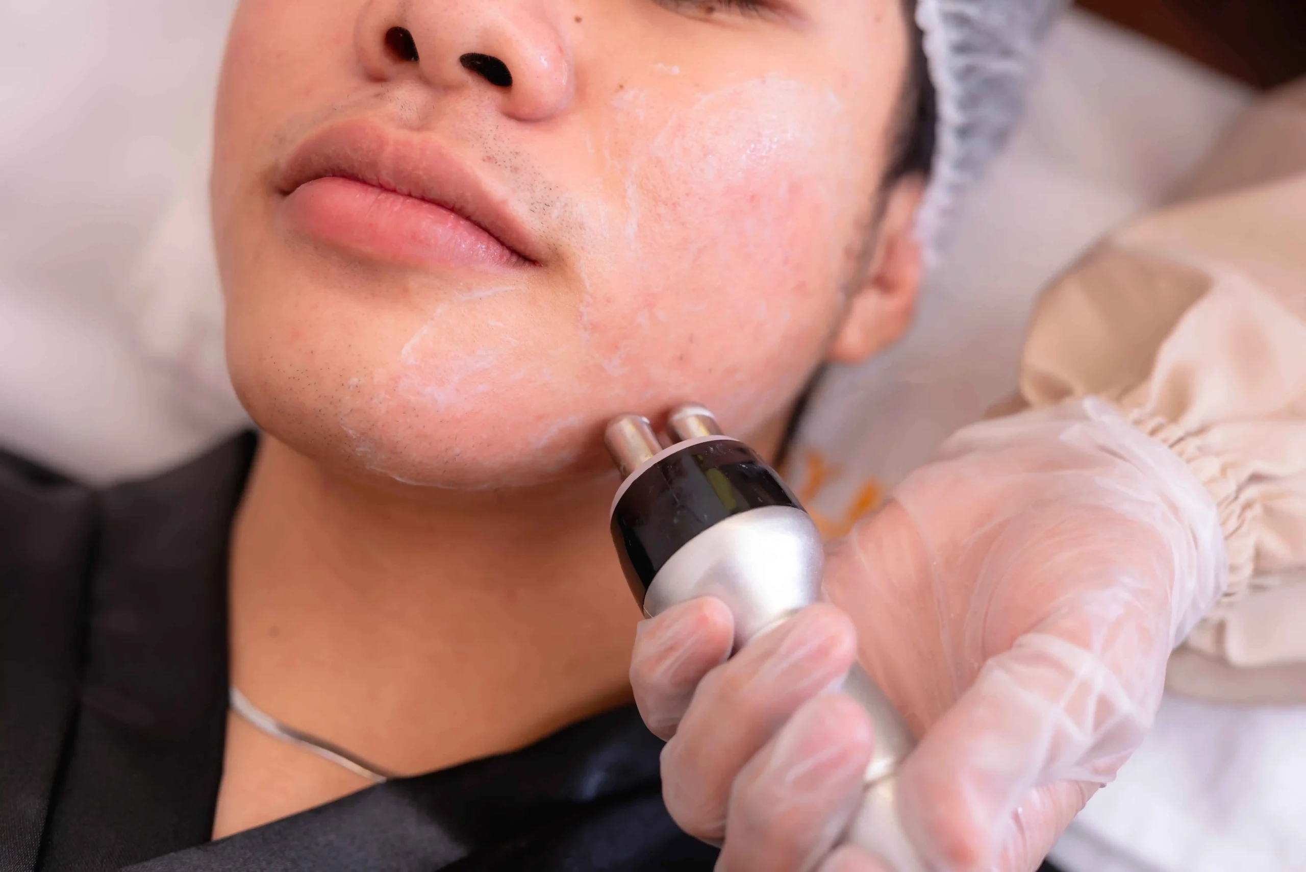 Med Spa for Men|Skincare