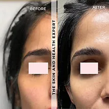 Sculptra-Temples